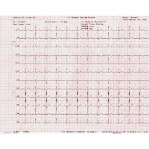 B-ecg-p10n